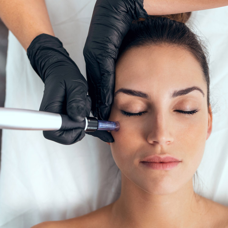 chica recibe tratamiento de dermapen facial