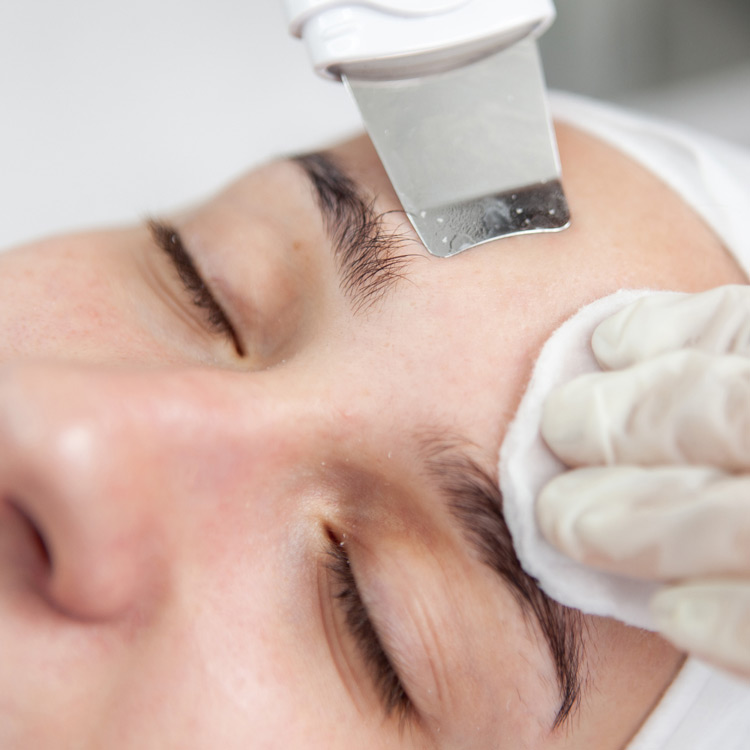 chica realizando limpieza facial mediante peeling ultrasónico